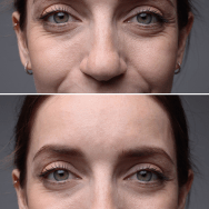 Skin Care Sarasota | Skincare Couture Facial Spa