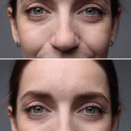 Skin Care Sarasota | Skincare Couture Facial Spa